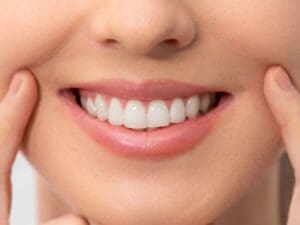 Teeth Deep Cleaning in Georgetown, TX - Trade Winds Dental